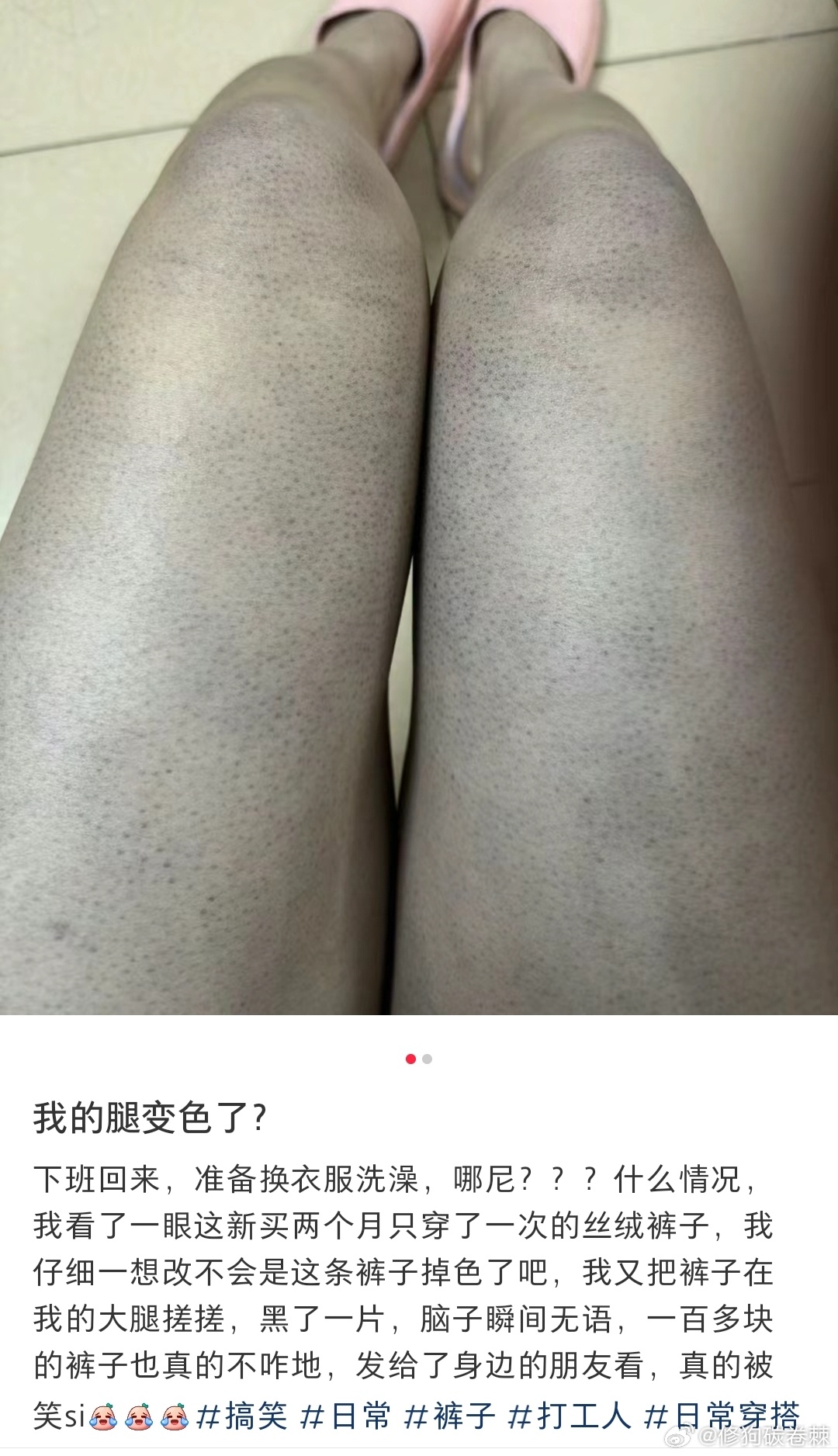 女子花百元购裤掉色，双腿染紫事件深度解析